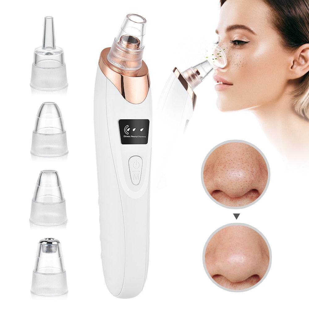 Beauty Electric Blackhead Remover - D N A Fitness&Beauty