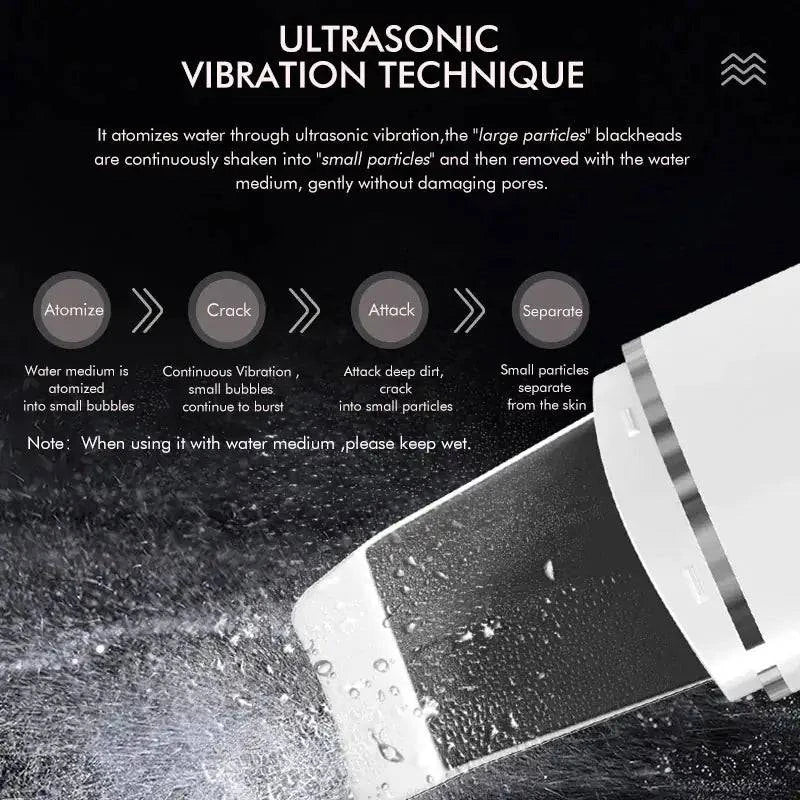 Ultrasonic Facial Spatula - D N A Fitness&Beauty